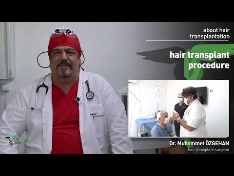 Hair Transplantation surgery (Md.Muhammet Ozgaehan)