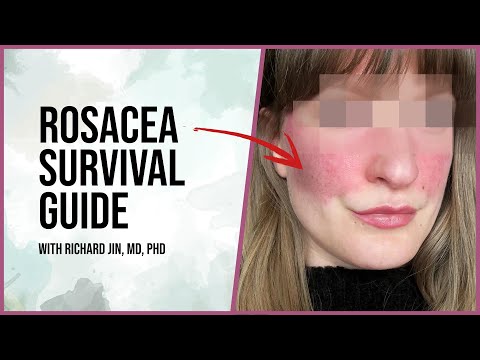 Rosacea Survival 101: Tips and Treatments for Clearer Skin