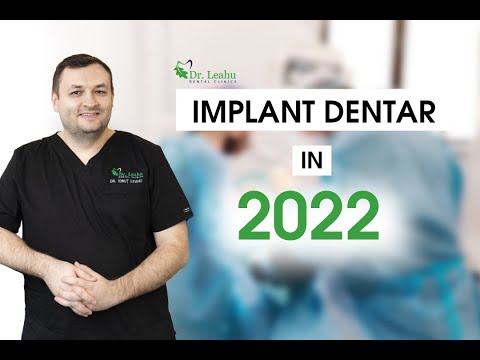 Cat costa un implant dentar in 2022 - Clinicile Dentare Dr. Leahu