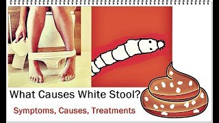 White Poop (Change in Color of Bowel Movement)  - Causes