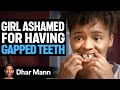 Girl Ashamed Of Her GAPPED TEETH Dhar Mann Studios