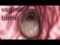 Vaginal Birth Natural Childbirth
