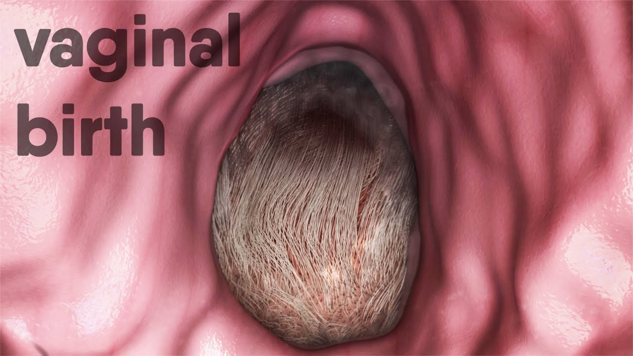 Vaginal-Birth, Natural -Childbirth
