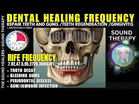 RIFE Biorife® teeth and gums - cavities sound therapy - gingivitis music - binaural beats subliminal