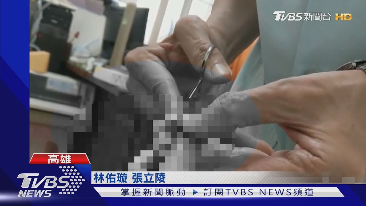 女控遭剪指大爆血 密醫竟嗆:不然你來用