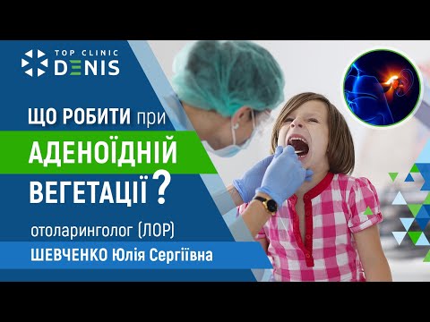 Что делать при аденоидной вегетации? - TOP Clinic DENIS