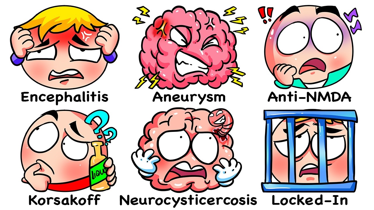 Every Brain Disease Explained In X Minutes