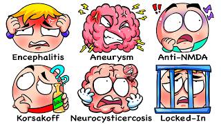 Every Brain Disease Explained In X Minutes