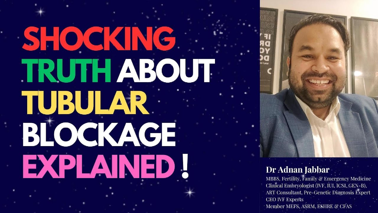 Shocking Truth About Blocked Fallopian Tubes | Breaking 11 Myths About Tubal Blockage