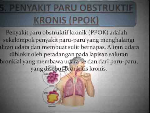 Latihan untuk perut pelangsing Penurunan berat badan dengan ramuan senna