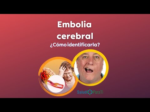 ¿QUÉ ES UNA EMBOLIA CEREBRAL?