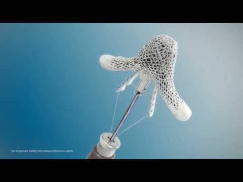 DR PRETORIAN: Despre procedura Mitraclip