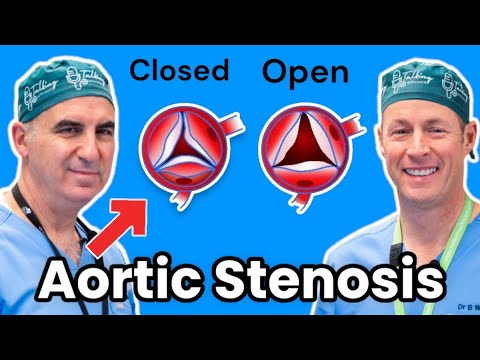 Aortic Stenosis and the TAVI Procedure: Insights from a Cardiologist