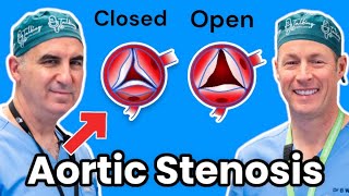 Aortic Stenosis and the TAVI Procedure: Insights from a Cardiologist