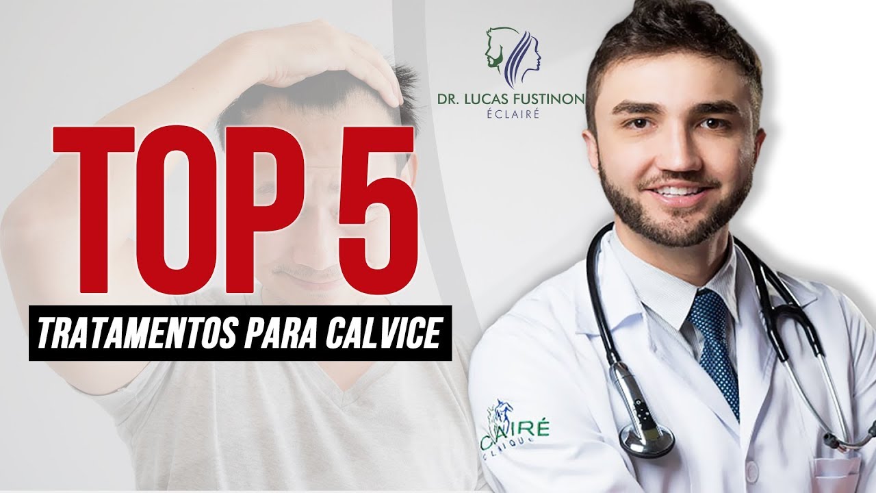 🔥 TOP 5 Melhores Tratamentos para CALVICE | Dr Lucas Fustinoni