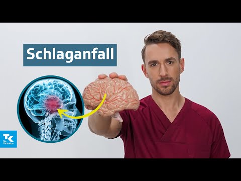 Schlaganfall verstehen: Ursachen, Symptome, Diagnose & Therapie | DocTommy
