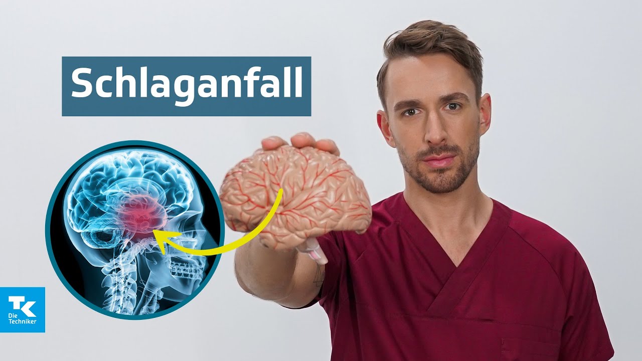 Schlaganfall verstehen: Ursachen, Symptome, Diagnose & Therapie | DocTommy