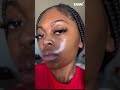 Remove Dark Spots And Melasma Quickly With SAAM Renewal Face Cream Skincare Skincareroutine