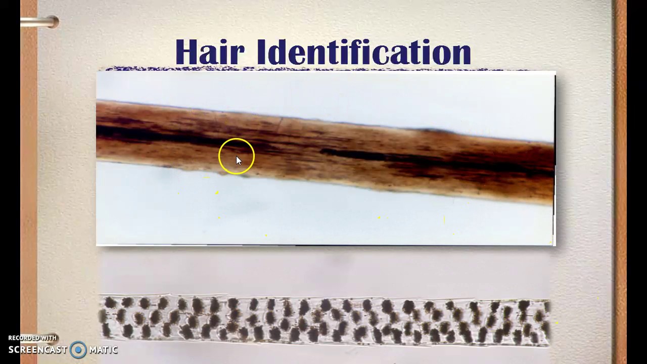 03-Forensics-Hair
