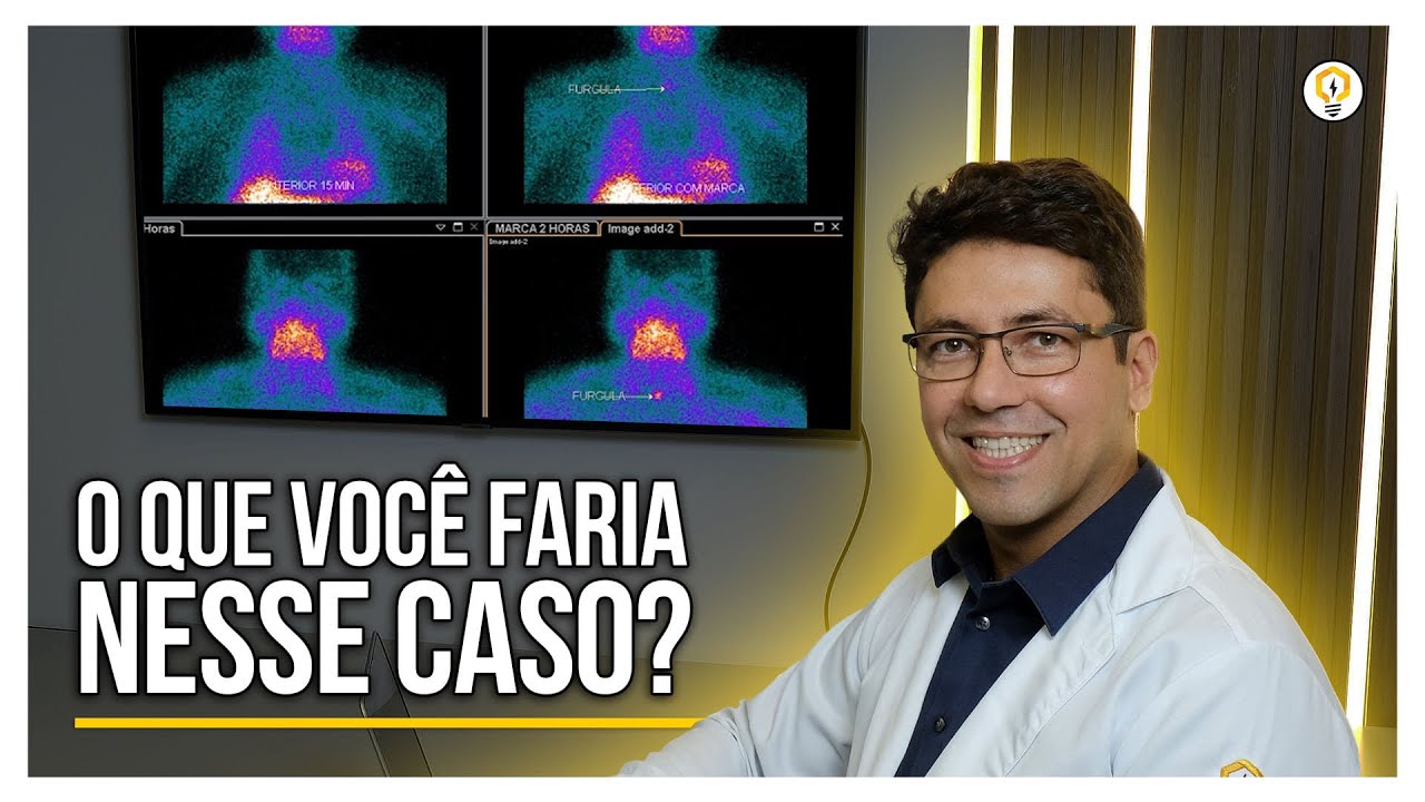 REVISÃO DE ADENOMA DE PARATIREOIDE