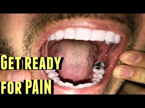 What's it like going to a dentist in prison?