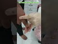 Gas Acidity And Indigestion 1 Min Press Front Side Of Index Finger And Backside Of Center Finger