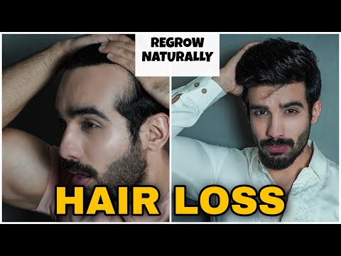 How to STOP HAIR FALL NATURALLY|REGROW Hair|Hair fall control| Dandruff|Hair Thinning(Men & women)
