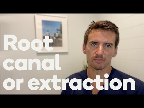 Root canals versus extractions