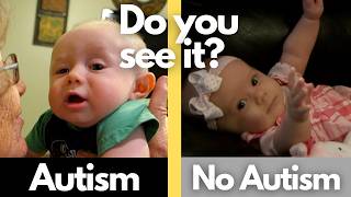 4 Signs of Autism in a Newborn