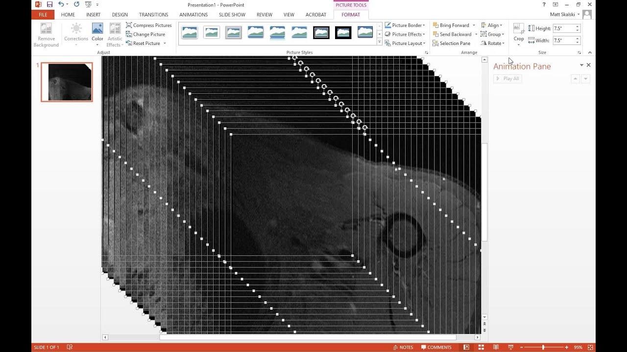 How to animate an image stack in powerpoint - radiology tutorial - MRI - CT