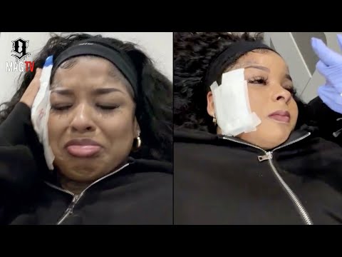 "My Heart Is Broken" Chrisean Rock FINALLY Gets Her Blueface Tattoo Removed! 💔