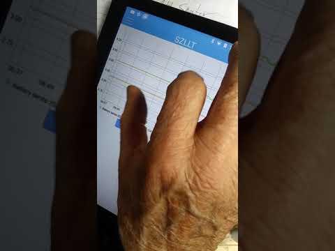 Bms the intelligent BMS and its Android app.
