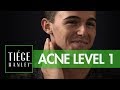 Tiege Hanley Acne System Level 1 Tiege Com
