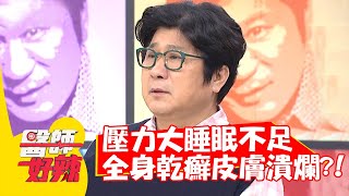 壓力大睡眠不足，全身乾癬皮膚潰爛？！【#醫師好辣】20210526 part3 EP1155 鄭丞傑 蔡逸姍