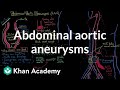 Abdominal Aortic Aneurysms Circulatory System And Disease NCLEX RN Khan Academy