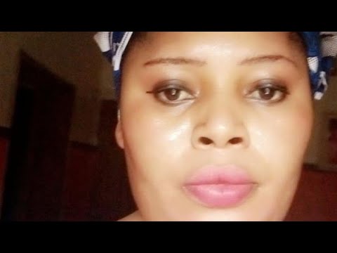 Benoquin monobenzone cream, packaging size: 30 gm