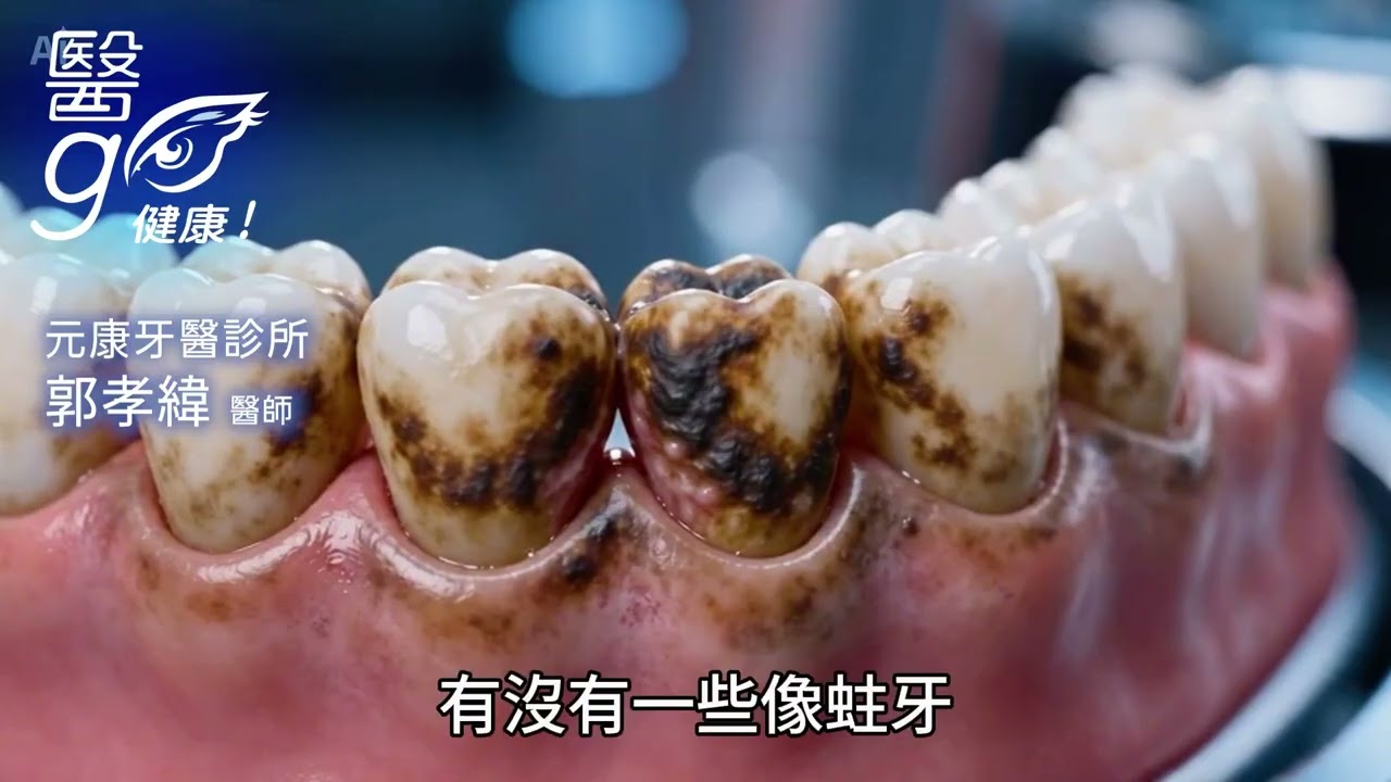 元康牙醫診所_郭孝緯醫師-牙齒美白是不是每個人都適合？ - AI健康醫療影片