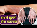 हाथ में खुजली होना Dermatitis से लेकर Dyshidrotic Eczema S