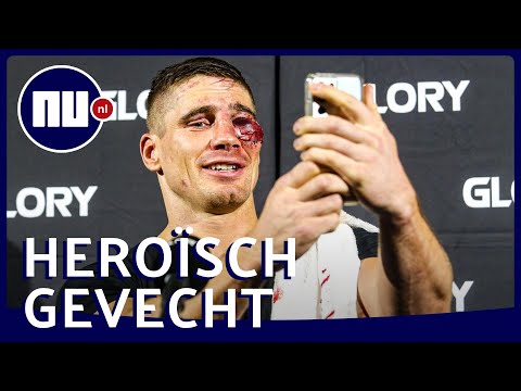 Watch Kickboxer Frustrated His Face Is So Bruised His iPhone Won't Recognize Him