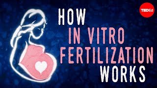 How in vitro fertilization (IVF) works – Nassim Assefi and Brian A. Levine