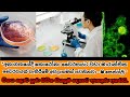 Disease X 2023 Next Pandemic Disease X Could Kill 50 Million SL Newsdot