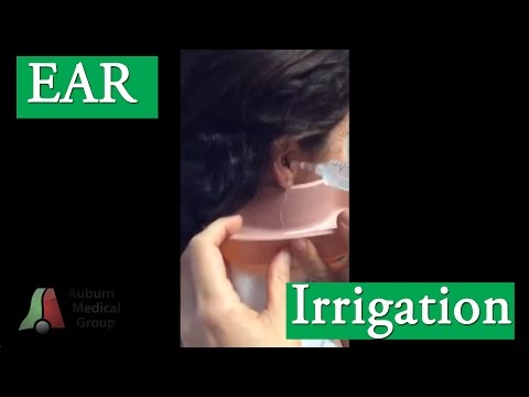 Ear Irrigation for Cerumen (Ear Wax) Removal | Auburn Medical Group