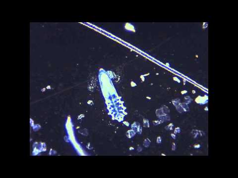Verme di trattamento di prevenzione Targhe da helminths della persona