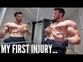 My First Injury After 8 Years Of Bodybuilding...