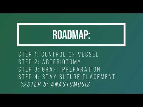 [FINAL] End-To-Side Vascular Anastomosis Instructional Video