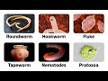 9 Warning Signs of Parasites