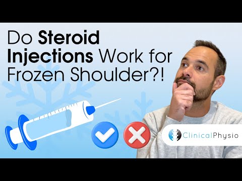 Do Steroid Injections Work for Frozen Shoulder?! Expert Physio Explains Research in Physiotherapy