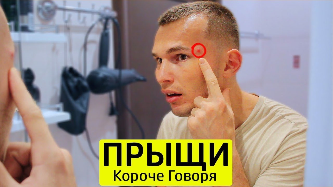 КОРОЧЕ ГОВОРЯ, БОРЮСЬ С ПРЫЩАМИ - ТимТим.