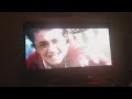 Harry Potter And The Chamber Of Secrets Broken Arm Scene
