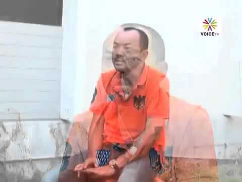 ความคิดเห็นของครีมขี้ผึ้งอย่างดีจากโรคสะเก็ดเงิน โรคสะเก็ดเงินคลอดบุตร